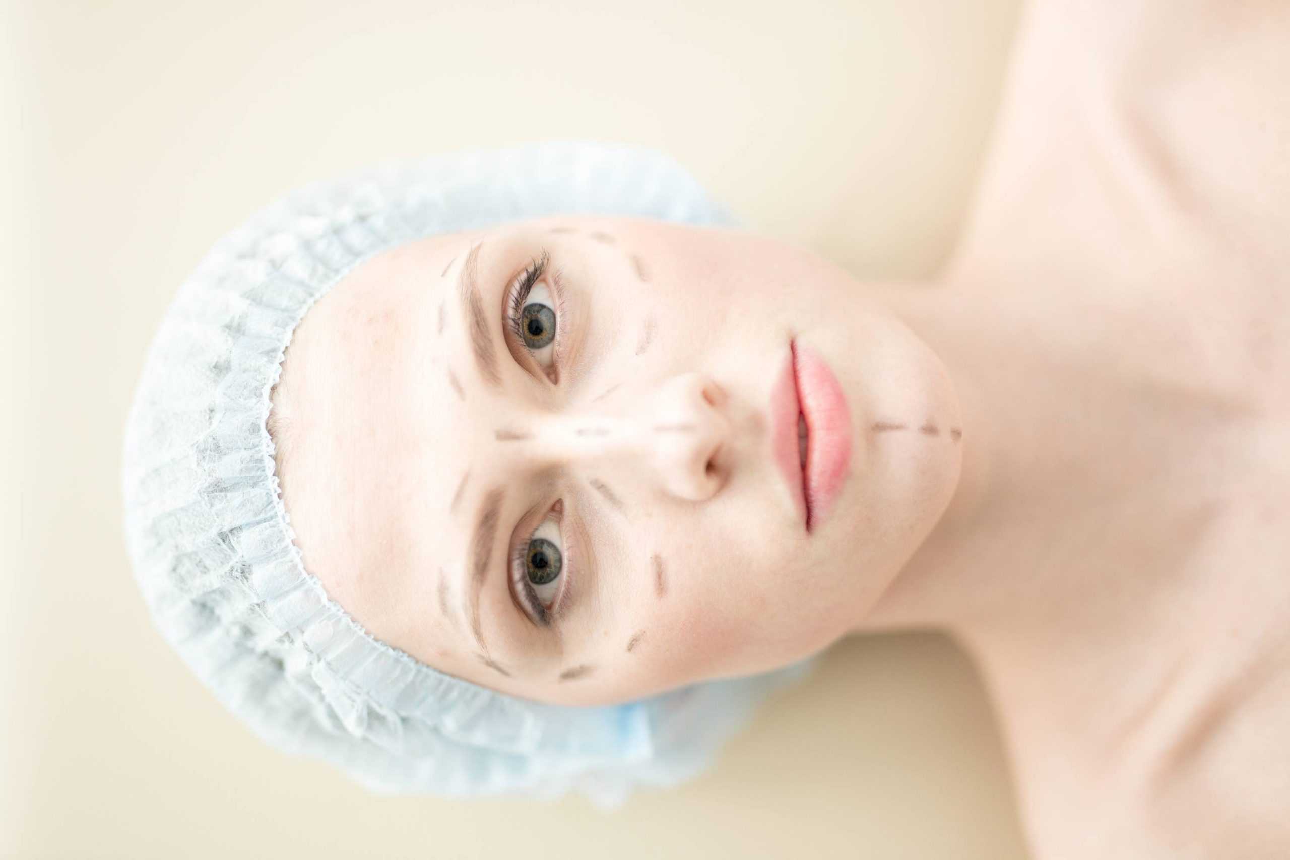 How to prepare for cosmetic plastic surgery